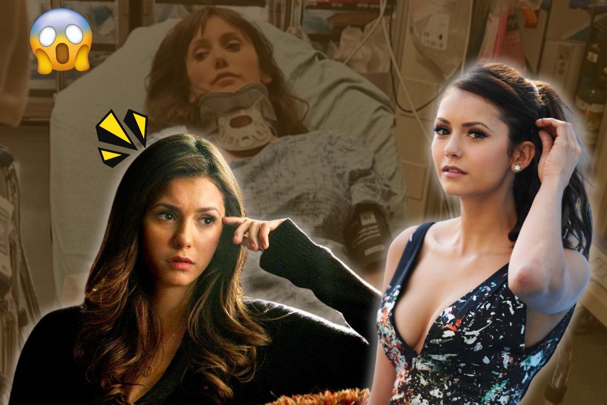 Nina Dobrev Plastic Surgery