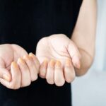 Whiten yellow nails