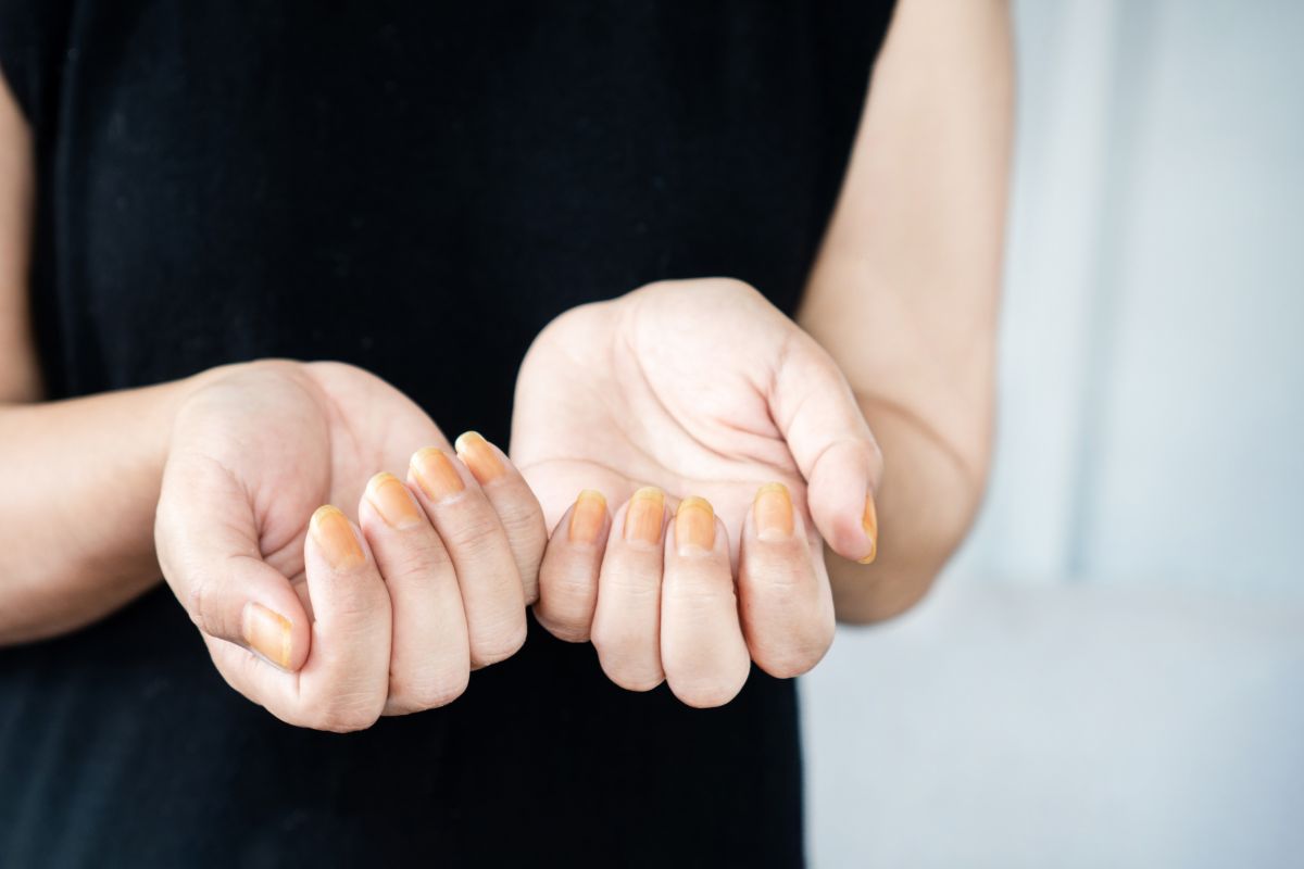 Whiten yellow nails