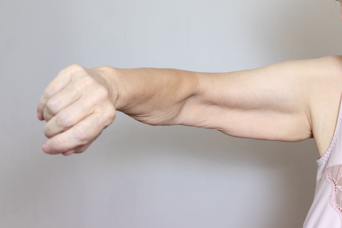 tighten skin after weight loss